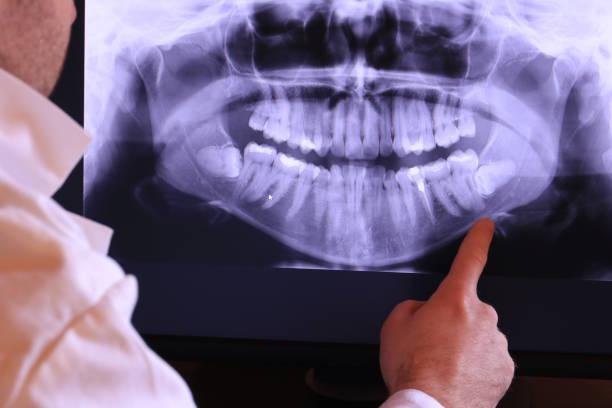 Best Emergency Treatment for Jaw Pain or Injury in Clinton, NY