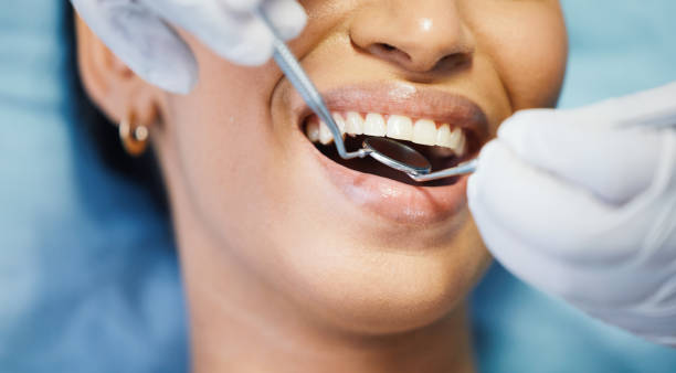 Best Emergency Denture Repair in Clinton, NY